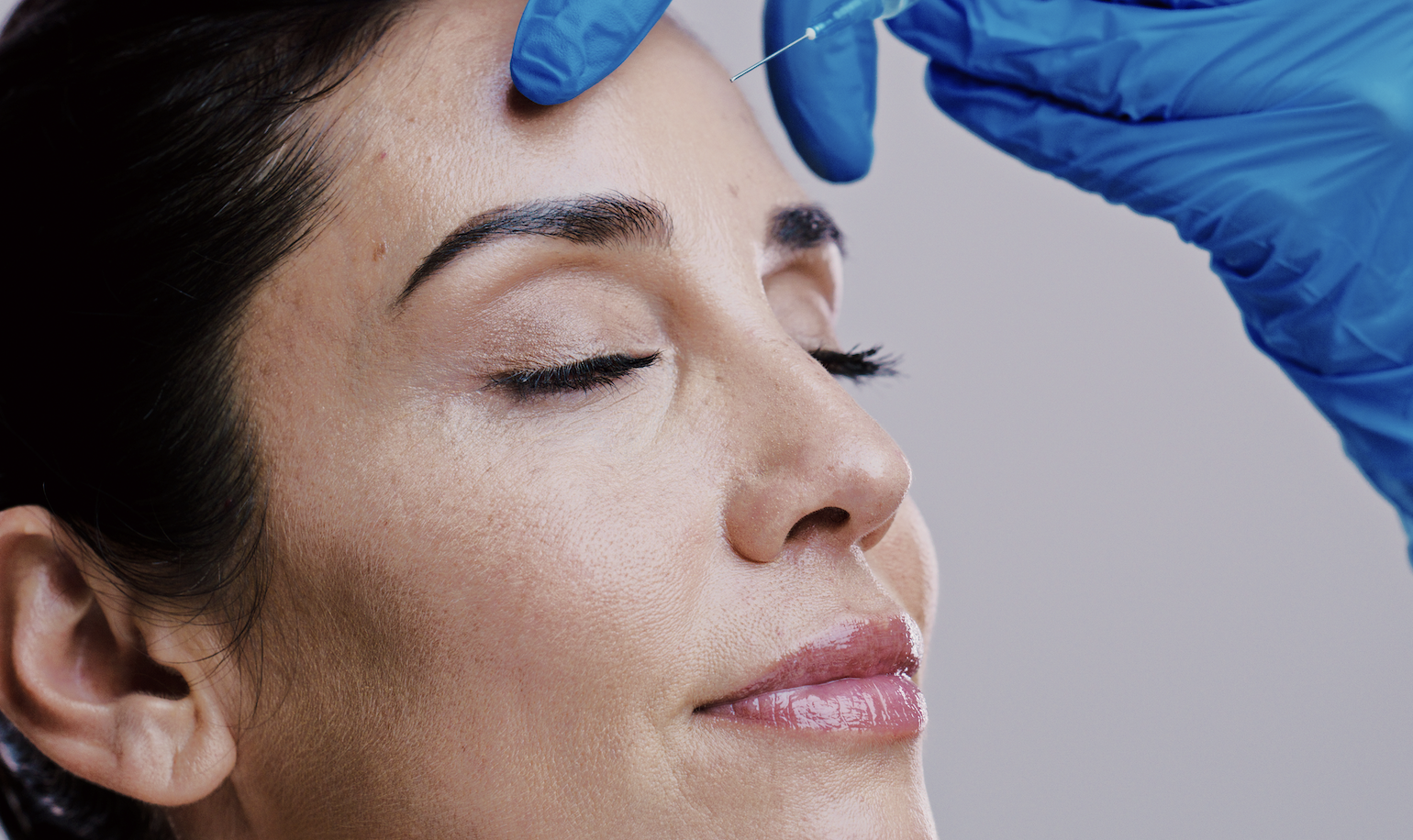 Dermal Fillers